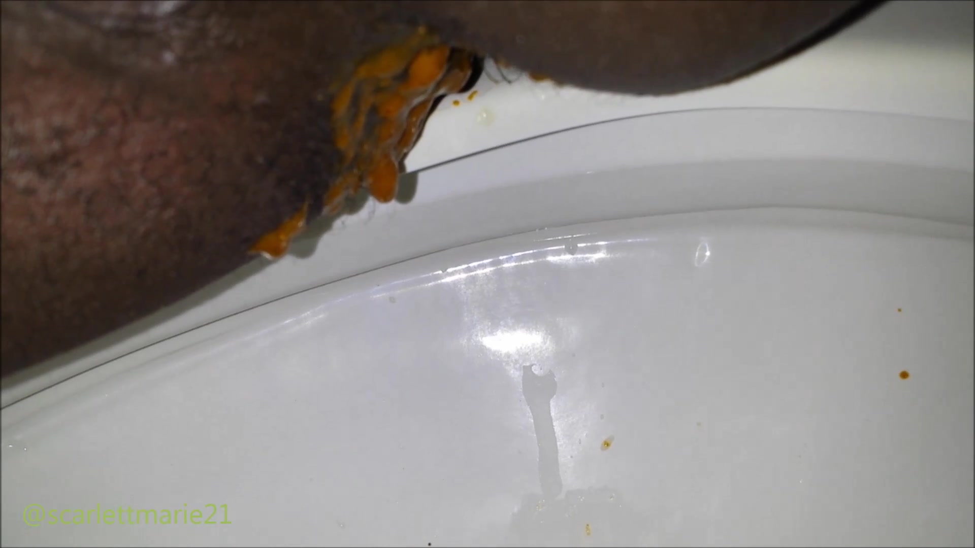 Click to play video Diarrhea - video 113